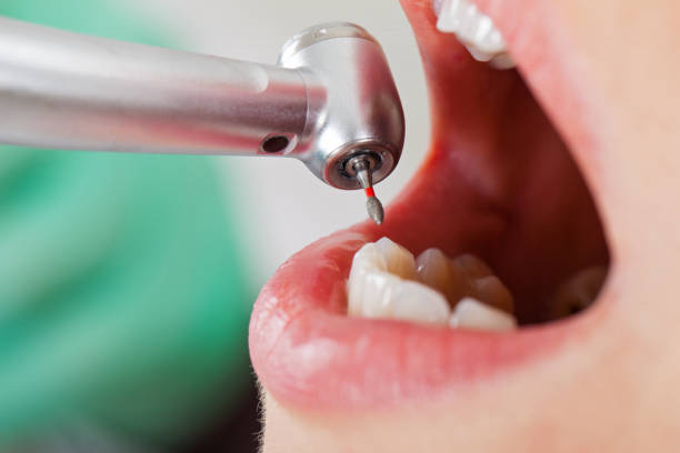 Best Cosmetic Emergency Dentistry in The Woodlands, TX